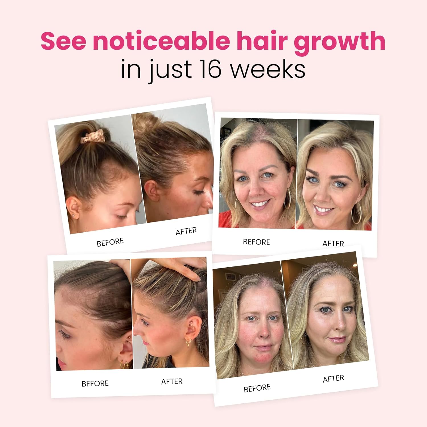 trybello Hair Growth Shampoo