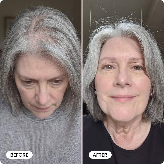 Bello Hair Booster Capsules